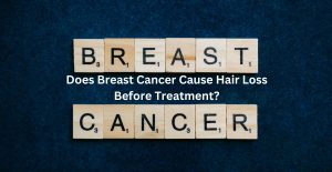 Read more about the article Does Breast Cancer Cause Hair Loss Before Treatment?